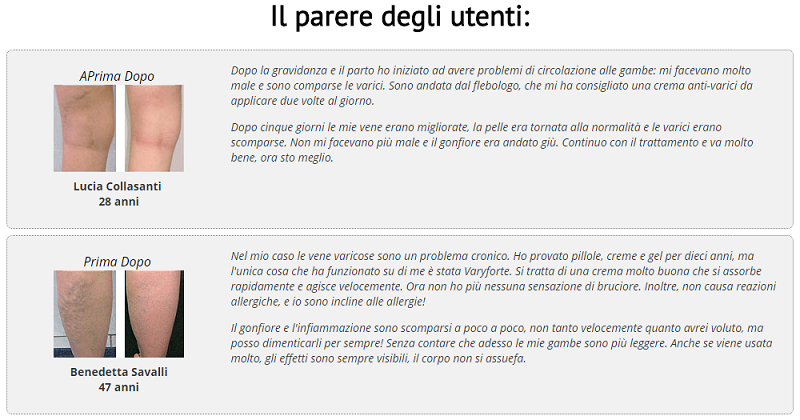 Trattamento di metodi moderni varicosity