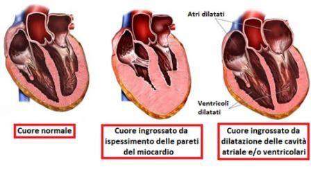 Cardiomegalia: cause, sintomi e terapie - Sanioggi.it